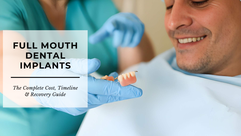 Full Mouth Dental Implants